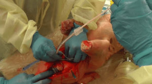 Syndey HEMS pig lab surgical airway