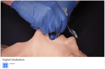 emsce Digital Intubation
