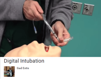 Gad Estis Digital Intubation